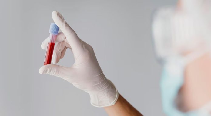 Científicos hallan variante genética hereditaria que protege contra la leucemia y otros cánceres de la sangre