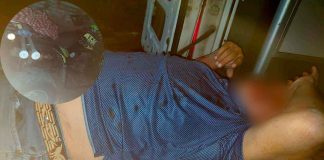 Motociclista resulta gravemente lesionado tras derrape en Apatzingán