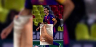Rafa Márquez muestra su “recuerdo de batalla”: la foto de su tobillo tras el juego de Leyendas Barcelona vs Morelia