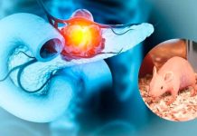 ¡Avance histórico! científicos logran eliminar el cáncer de páncreas en modelos animales