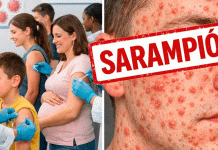 Sarampión en México: quiénes deben vacunarse y cómo protegerse