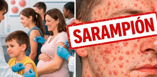 Sarampión en México: quiénes deben vacunarse y cómo protegerse