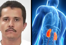 Informes revelan que problemas de salud afectaban a “El Mencho” en sus últimos años