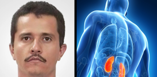 Informes revelan que problemas de salud afectaban a “El Mencho” en sus últimos años