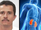 Informes revelan que problemas de salud afectaban a “El Mencho” en sus últimos años
