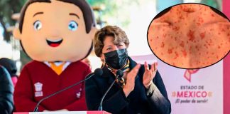 Sin brote grave, pero con prevención: Edomex llama a vacunar contra sarampión