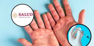 ¿Dónde vacunarse contra el sarampión en Morelia? Estos son los 12 módulos activos de la SSM