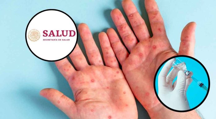 Ssa garantiza disponibilidad de vacunas contra el sarampión y detalla ejercicio presupuestal 2025