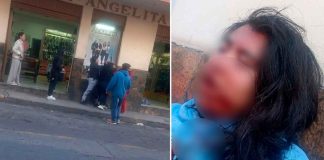 Mujer resulta sin su cachete tras riña en Ciudad Hidalgo