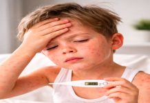 ¿Crees que es gripe? Podría tratarse de sarampión: estos son los primeros síntomas de la enfermedad viral