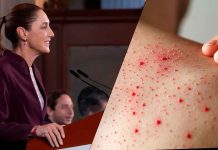Sarampión repunta en México: reportan 9,487 casos durante la mañanera de Sheinbaum
