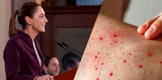 Sarampión avanza en México: suman 9,487 casos y 410 nuevos contagios en una semana, informa Sheinbaum en la mañanera