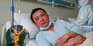 Autoridades sanitarias reportan deceso por sarampión en la capital de México