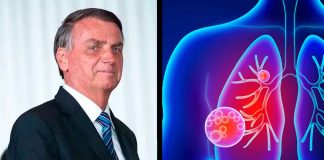 Jair Bolsonaro es hospitalizado por infección pulmonar en Brasil