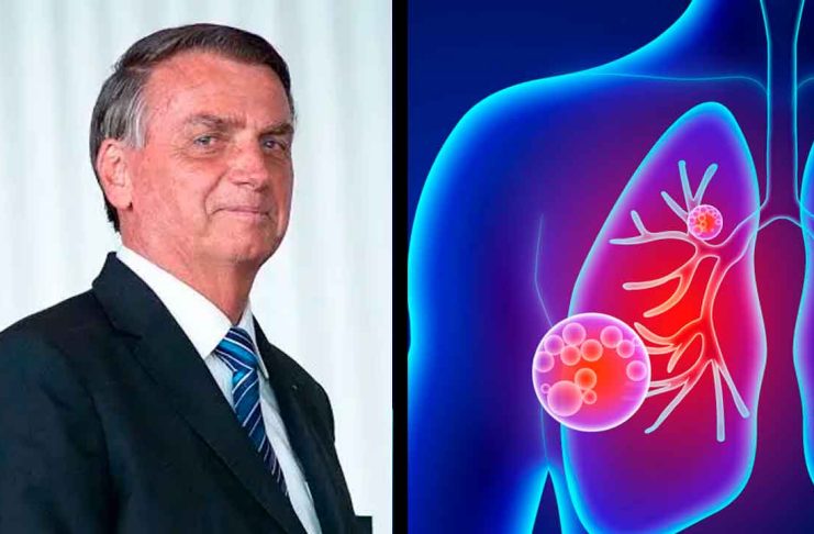 Jair Bolsonaro es hospitalizado por infección pulmonar en Brasil
