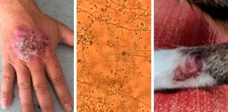 Detectan en Uruguay hongo que se transmite de gatos a humanos; activan vigilancia