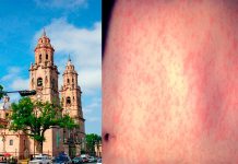 Michoacán suma 110 casos confirmados de sarampión; se mantiene entre los estados con mayor incidencia