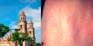 Michoacán suma 110 casos confirmados de sarampión; se mantiene entre los estados con mayor incidencia