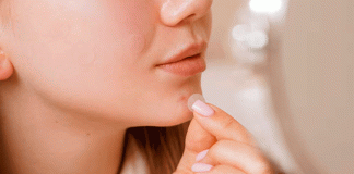 Parche de acné: cuándo son útiles y quiénes deben evitarlos