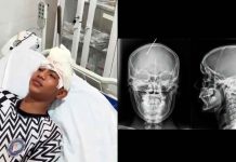 #VIDEO // Le clava un cuchillo en la cabeza a su hermano tras una fuerte discusión.