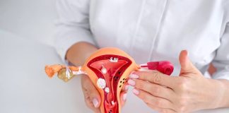 Día Mundial de la Endometriosis: enfermedad que afecta a 1 de cada 10 mujeres en México