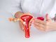 Día Mundial de la Endometriosis: enfermedad que afecta a 1 de cada 10 mujeres en México