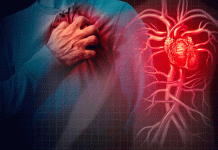 Microinfartos silenciosos: el daño invisible que puede afectar tu cerebro