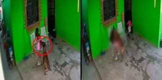 VIEDEOFUERTE// Brutal ataque de perro deja a niña con 68 puntos de sutura