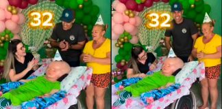 VIDEO//Cumple 32 años joven con hidrocefalia; médicos le daban solo meses de vida