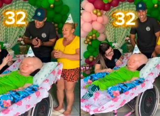 VIDEO//Cumple 32 años joven con hidrocefalia; médicos le daban solo meses de vida