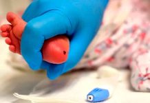 Se realizará tamizaje para detección temprana de enfermedades renales en Los Azufres