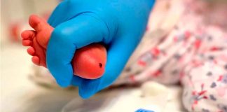 Se realizará tamizaje para detección temprana de enfermedades renales en Los Azufres