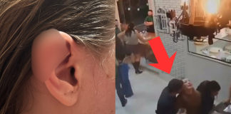 #VIDEO // Sujeto arranca oreja a su novia de una mordida en plena fiesta