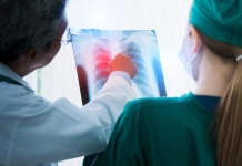 ¿Pacientes con cáncer de pulmón sin ser fumadores? Comer “sano” podría estarte dañando sin saberlo