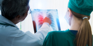¿Pacientes con cáncer de pulmón sin ser fumadores? Comer “sano” podría estarte dañando sin saberlo