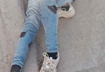 Mujer resulta gravemente herida tras ataque de perro en San José del Cabo