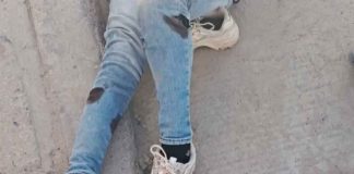 Mujer resulta gravemente herida tras ataque de perro en San José del Cabo