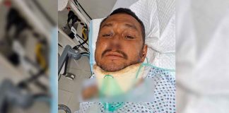 Buscan a familiares de hombre atropellado; permanece grave en hospital de Tlajomulco