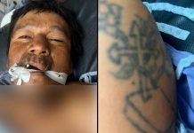 ¡Urgente! Buscan familiares de hombre en estado crítico en Hospital General de Uruapan