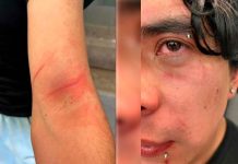 Alumno es atacado con navajas por sus compañeros en baño de su preparatoria