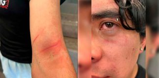 Alumno es atacado con navajas por sus compañeros en baño de su preparatoria