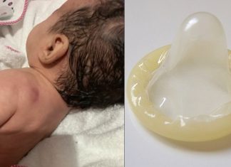 Bebé de dos años defeca preservativos en su guardería; madre es investigada