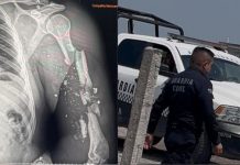 #VIDEOS // “Dales en la cabeza” Policías balacean a motociclistas en Morelia; perderá un brazo la víctima
