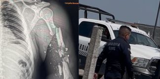 #VIDEOS // “Dales en la cabeza” Policías balacean a motociclistas en Morelia; perderá un brazo la víctima