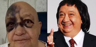 Tras estar 8 horas inconsciente por un accidente, Luis de Alba reaparece golpeado