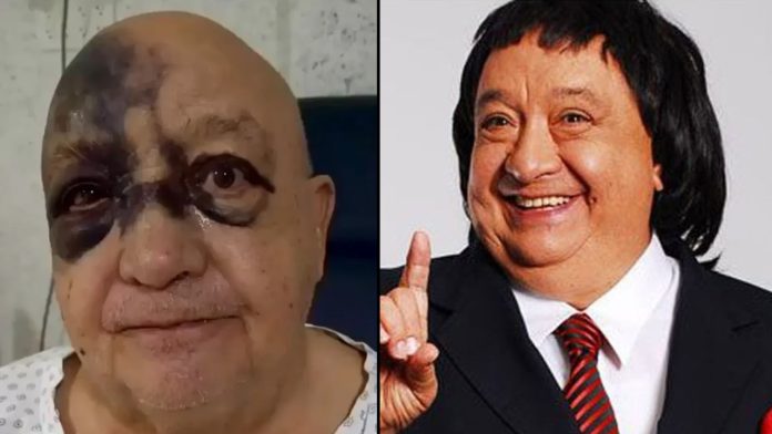 luis-de-alba-caida-accidente-mapache-atomico