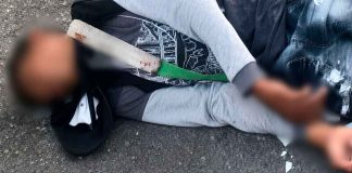 Automovilista embiste a motociclista y escapa; joven es hospitalizado en Apatzingán