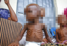 UNICEF alerta que 3.7 millones de niños en Afganistán están en riesgo de desnutrición