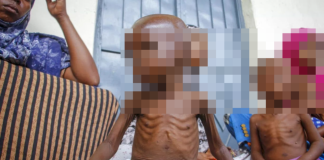 UNICEF alerta que 3.7 millones de niños en Afganistán están en riesgo de desnutrición