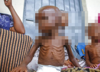 UNICEF alerta que 3.7 millones de niños en Afganistán están en riesgo de desnutrición